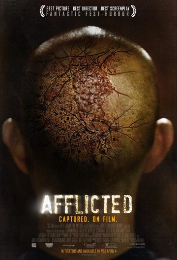 折磨 Afflicted【2013】【加拿大/美国】【悬疑/恐怖/惊悚】